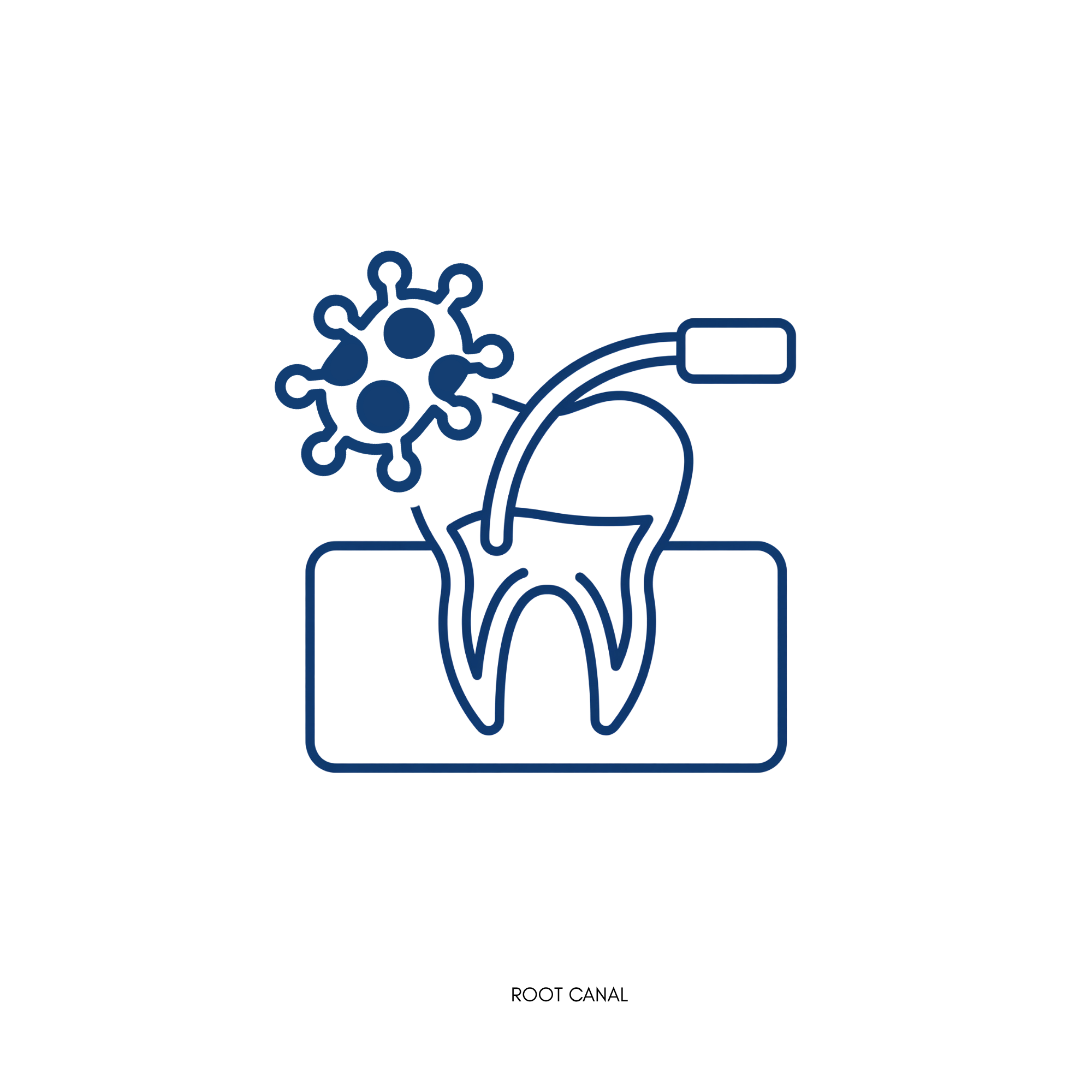 Root Canal Treatment